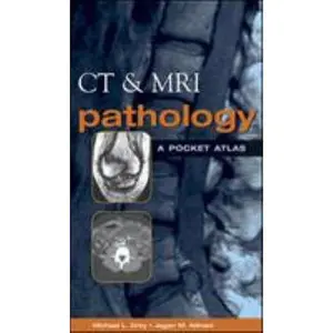 USED Book - CT & MRI Pathology: A Pocket Atlas by Michael L. Grey (Paperback) - english