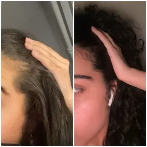 Mermaid Hair Growth Serum - Natural Formula for Accelerated Hair Growth - 30-Day Supply Included