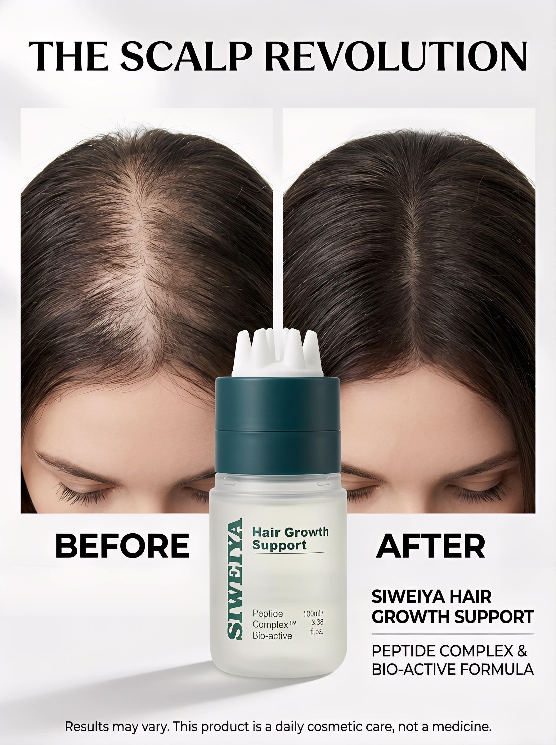 Korean Hair Growth Scalp Serum  with Built-in Scalp Massager— Peptide Complex Formula for Thinning Hair, Supports Fuller-Looking Strands, Plant-Based Bio-Active Care to Strengthen Roots & Soothe Scalp, Scalp Care Product. Haircare product, 100 ml