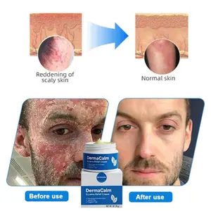 Promo 2-Pack: DermaCalm Natural Herbal Sensitive Skin Repair Cream – For Eczema, Psoriasis, Itching & Redness, Oatmeal Soothing Formula, Hypoallergenic & Fragrance-Free – 30 g