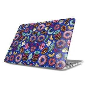 Glazed Craze (Blue) Macbook Hard Case