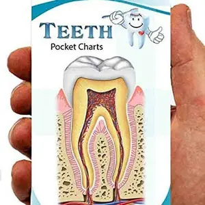 Blue Tree Publishing Dental Anatomy Pocket Chart, 25 clear pictures of teeth, cavities, implants and more. Great for Dental students, Dental Hygienists or anyone looking to teach about oral health