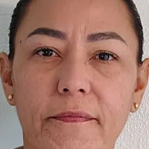 Product Review of COSRX The Peptide Collagen Hydrogel Eye Patch 60 Patches Reduce Puffiness Hydrate Under-Eye Bags in 10 Minutes from M**s r**l c**g **