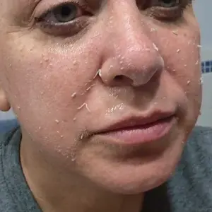 Product Review of [Dr.Melaxin Official] Peel Shot Glow Rice Ampoule Duo - Serums for Brightening, Exfoliating, and Moisturizing - Suitable for All Skin Types from H**r V**a