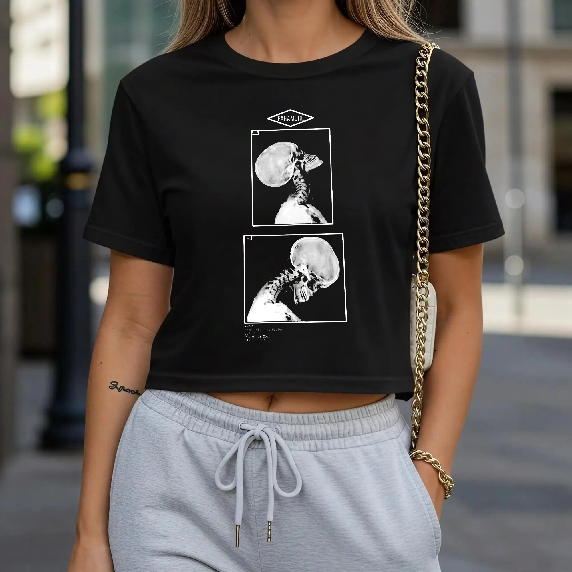 Skeleton X-ray Graphic Babytee Vintage Rock Tee, Gothic Skull Anatomy Shirt, Dark Aesthetic Streetwear, Y2k Grunge Fashion, Alternative Style Unisex Casual Top, Music Lover Gift