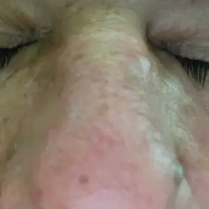 Product Review of NIDA Youthful Formula Ultimate Moisturizing Cream (100mL) / Collagen, Niacinamide, Centella Asiatica, Hyaluronic Acid / Wrinkles, Dark Spots, Skincare Hydrating Daily Moisturizer Moisture Hydrate from a**5