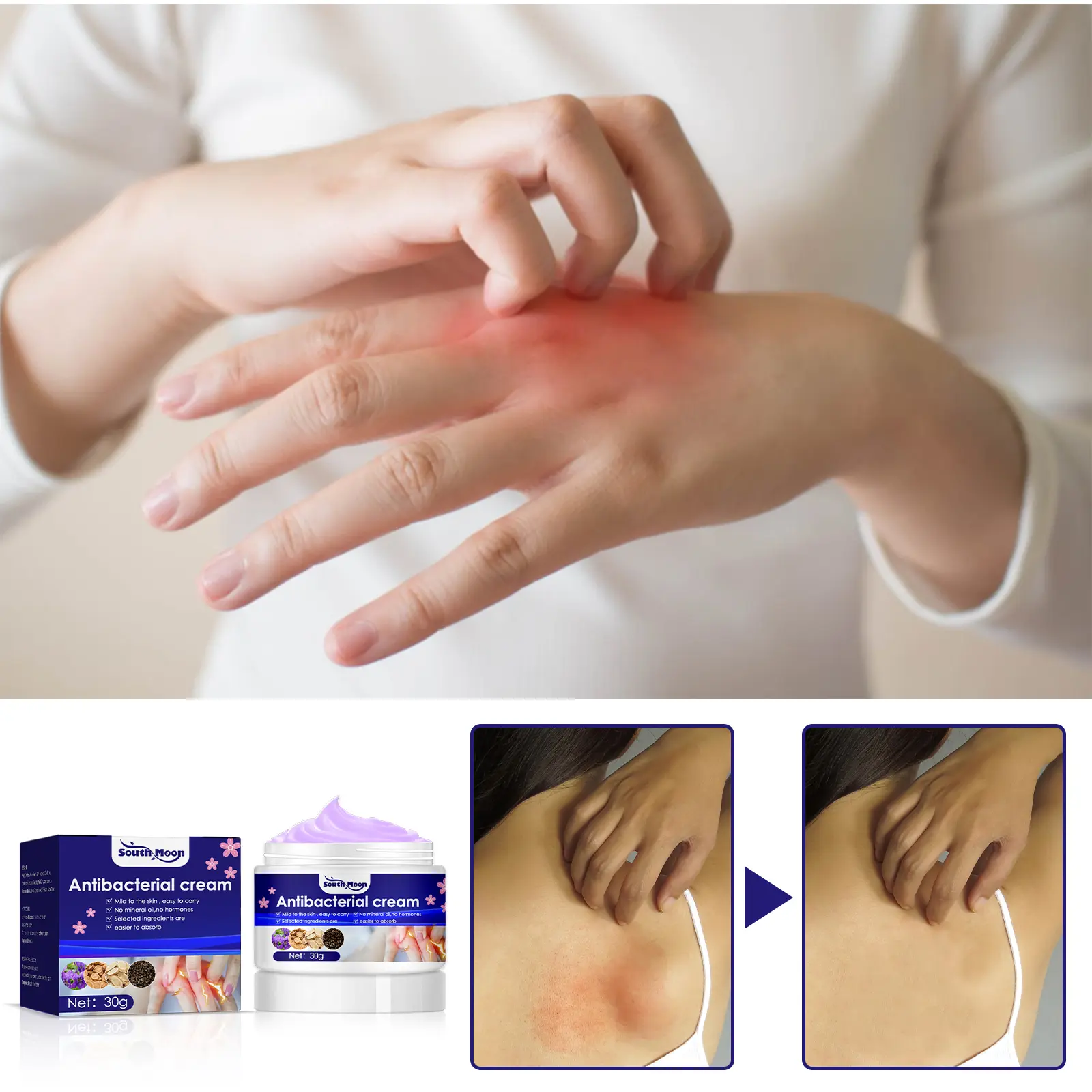 Zihua Diding Anti-Itch Cream for Mosquito Bites, Topical Itching Relief Treatment with Glycerin Stearate and Carbomer, Relieves Itch, Prevents Mosquito Bites, Redness, Apply Daily