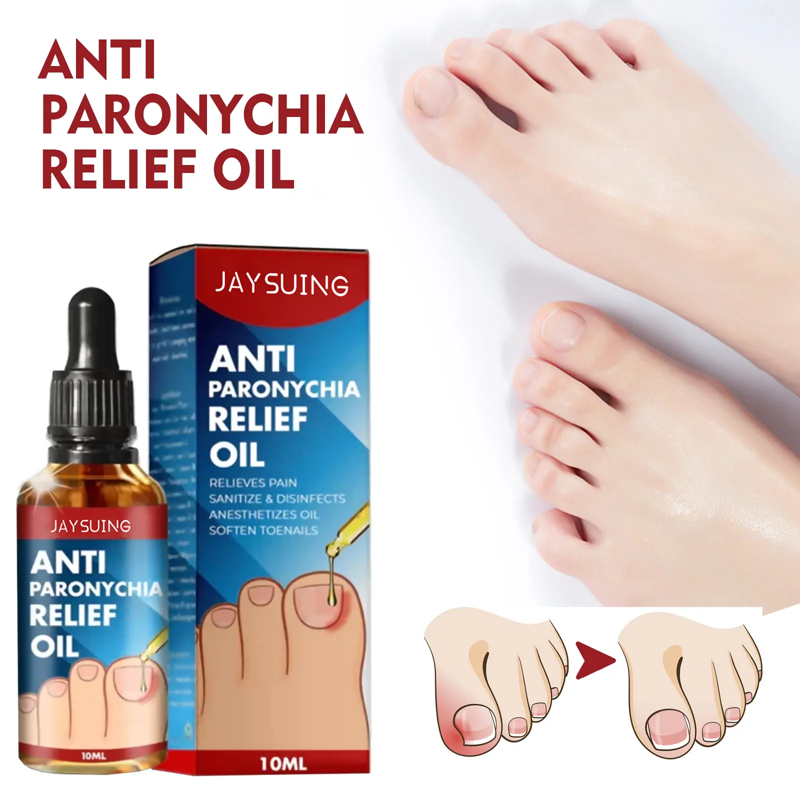 Anti Paronychia Relief Oil Paronychia Nursing Oil Nail Cuticle Care Treatment Repair for Nails