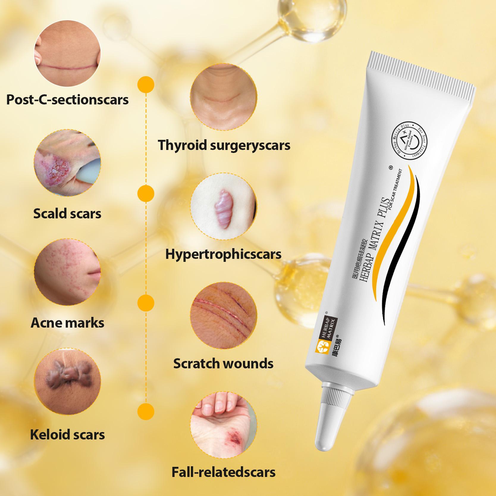 HERBAP MATRIX Plus Professional Silicone Scar Treatment | For Stretch Marks, C-Section Scars & Acne Marks | Fades Old & New Dark Scars | Prevents Scar Thickening | Face & Body Skin Repair Cream | GMPC ISO 9001 Certified