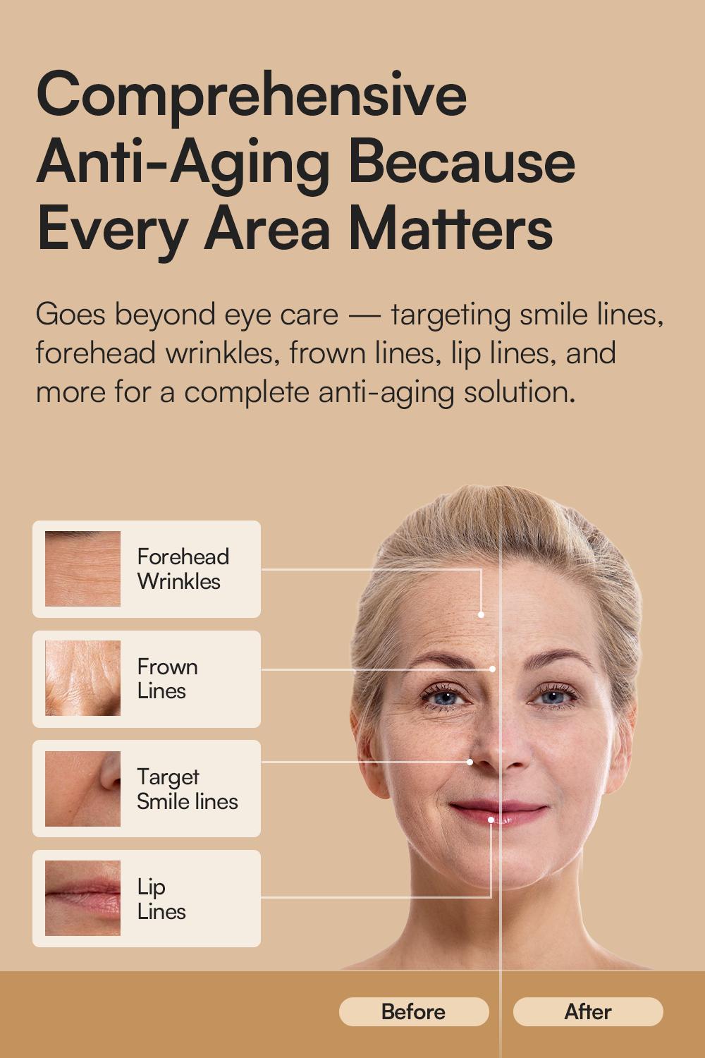 INIA LUMIN 4-in-1 Eye Skincare Wand – 3 Mins a Day for Fewer Lines in 14 Days & Less Puffiness in 21, FDA-Cleared, Spa-Level Results at a Fraction of the Price, Lift & Brighten Eyes in Just Weeks