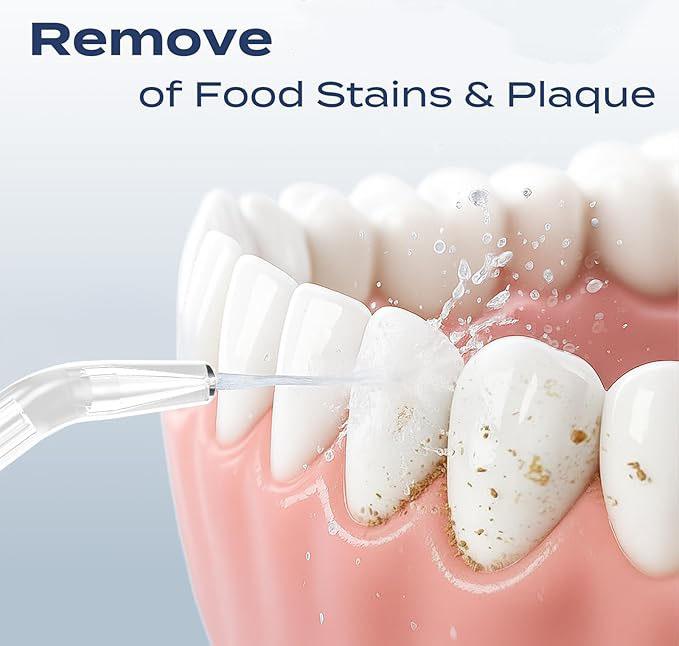 Wireless Oral Irrigator  Deep-Cleaning Water Flosser: 4 modes 4 nozzles  suitable for those with braces and sensitive teeth Rechargeable—ideal for home and travel | Fast USB charging