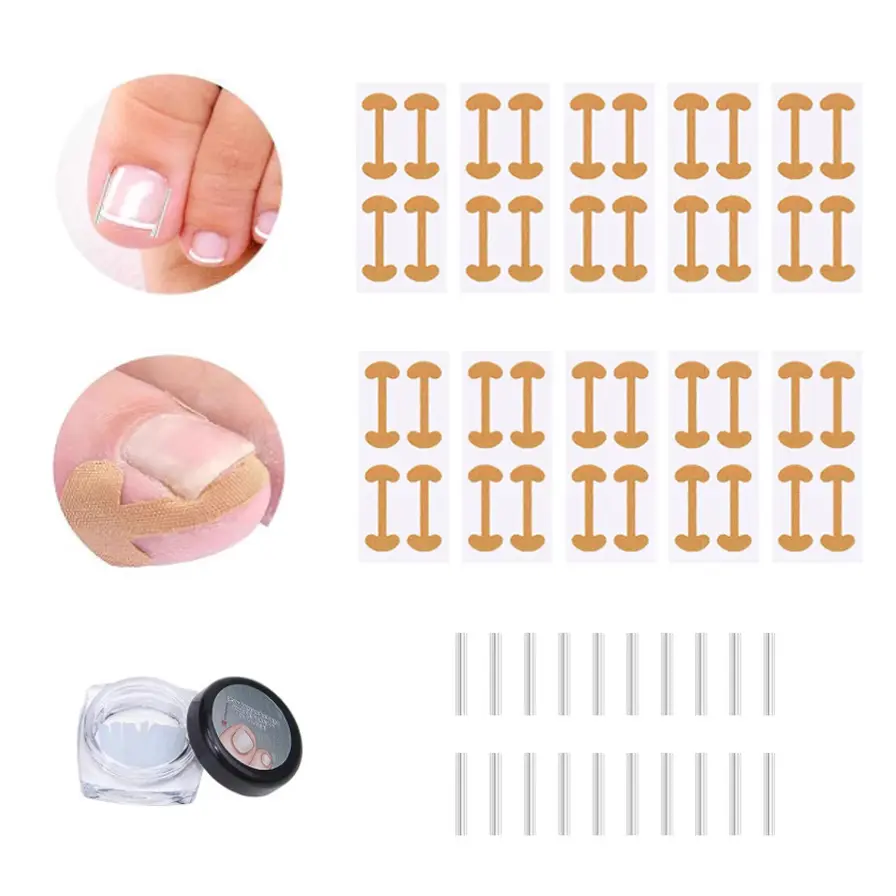 Ingrown Toenail Repair Elastic Stretch Strips, Adjustable Size Toe Care Protective Gear, 10 Pcs Pedicure Correction Patches, 1 Set[40 Stickers + 20 Inlays]