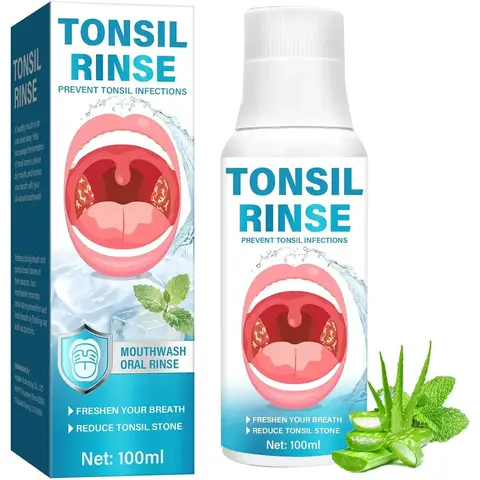 Tonsil Stone Remover Mouthwash - Natural Herbal Formula Mouthwash Cleanser, 30ml Gentle Oral Care Liquid, Prevents Bad Breath, Soothes Tonsils, Unisex for All Ages (Scientific Ratio), Tonsil Stone Mouthwash, Bad Breath Mouthwash