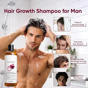 Biotin Rosemary Onion Three-In-One Shampoo, Strong Cleansing, Oil Control, Volumizing, Deep Nourishment, Summer Hair Care