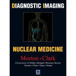 USED-Diagnostic Imaging: Nuclear Medicine by Janis P. O'Malley MD (Hardcover)