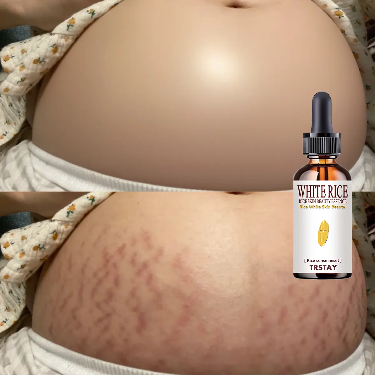 Hyaluronic Moisturizing Body Serum - Lightweight, Refreshing, Non-Greasy Skin Care for Dry Skin, Leaves Soft and Silky-Smooth, Suitable for Daily Application
