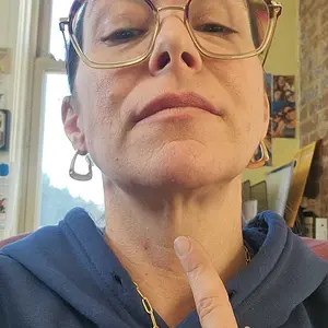 Product Review of [Dr.Melaxin Official] CACTOX V-LIFTING MEWING BAND with Cactus Cooling Reduce Puffiness & Pore Tightening for Visible Pore Care Skin Repair from L**h