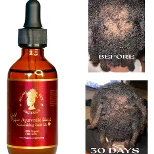 Madame Vo's Gold Apple Ayurvedic Blend Stimulating Hair Oil for Hair Growth