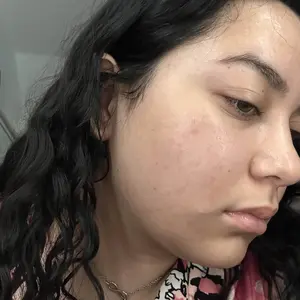 Product Review of Lion Pair Acne Cream Acne Treatment Pimples Removal Cream Pair Acne Creamy Foam Facial Wash Gentle Antibacterial from I**️