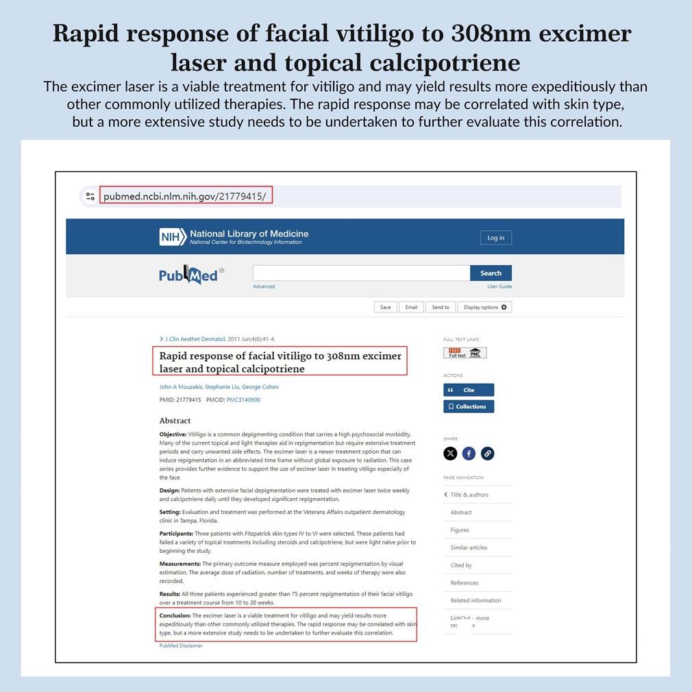 ZJZK 308nm Excimer Phototherapy Device with 49 Diodes, Blue Light Therapy for Vitiligo, Psoriasis, Eczema, Atopic Dermatitis, Fungal Skin Disease, Hypopigmentation, Safe Targeted Home Use, Fast Recovery, Prevent Recurrence, Portable Handheld