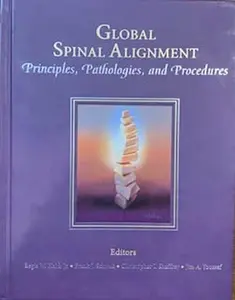 USED-Global Spinal Alignment: Principles, Pathologies, and Procedures by Frank J. Schwab (Hardcover)