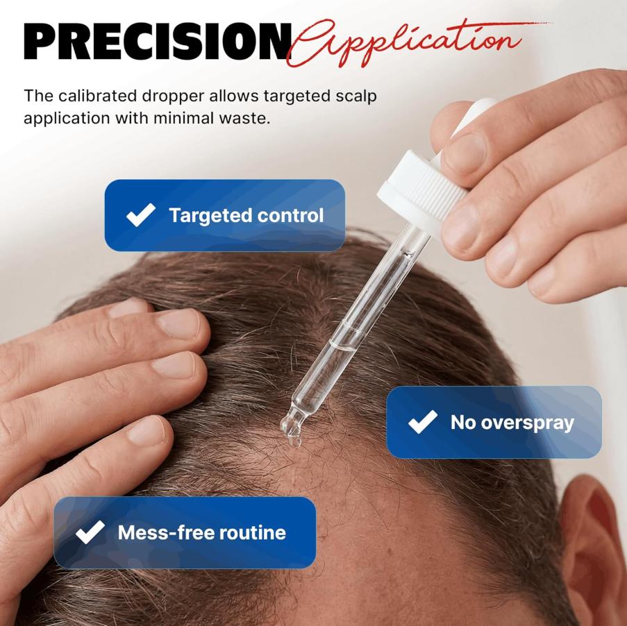 KIRKLAND 5% Minoxidil Hair Growth Solution (Unisex), includes a free microneedle roller, 3-month supply | Improves thinning hair from the roots, increases hair density, and promotes healthy growth. Dermatologist tested.