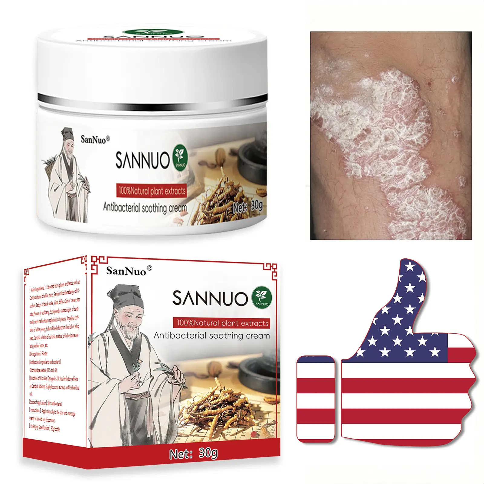 SanNuo All-Natural Soothing Cream for Eczema & Psoriasis – Herbal Relief for Dry, Itchy, Sensitive Skin , Anti-Bacterial Skin Defense (Hydrating, Safe