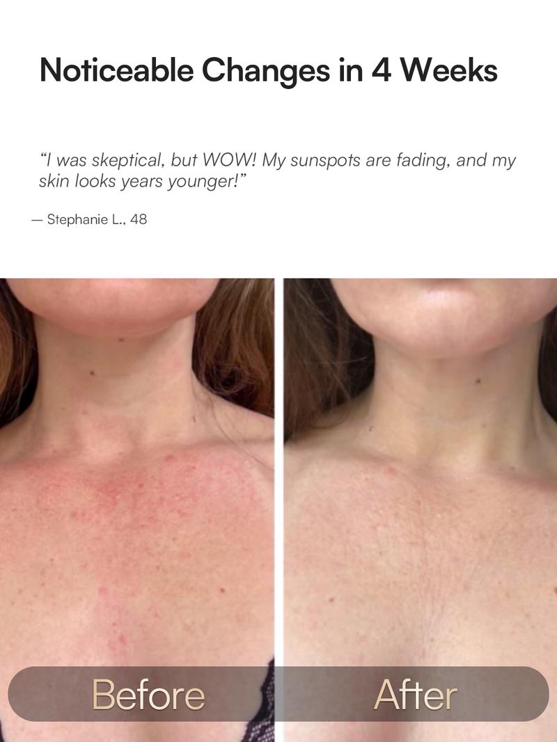 【LIVE ONLY】INIA GLOW Neck & Chest Red Light Mask – 850nm NIR | Fade Wrinkles & Spots | Lift & Firm in 4 Weeks - Red Light Skincare Device with 2600mAh Rechargeable Controller, Clinic-Grade, Full Coverage