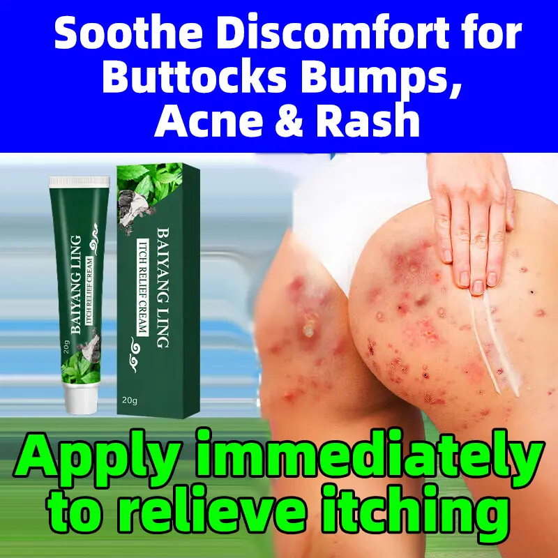 Buttock Anti-Itch Cream, Antibacterial Ointment for Skin Itching Relief, Soothe Itchy Skin, Relieve Skin Irritation, Redness & Skin Discomfort, External Skin Care Ointment