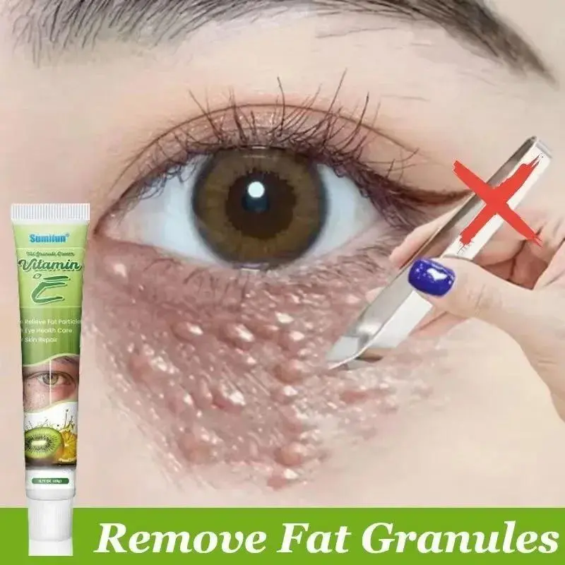 Under Eye Cream - Fat-Removing Eye Bag Treatment Skincare with Pore-Unclogging, Oil Control, Balance Oil, Conditioning, Makeup Residue Lift, Moisturizing Benefits, Cream Drop Formula