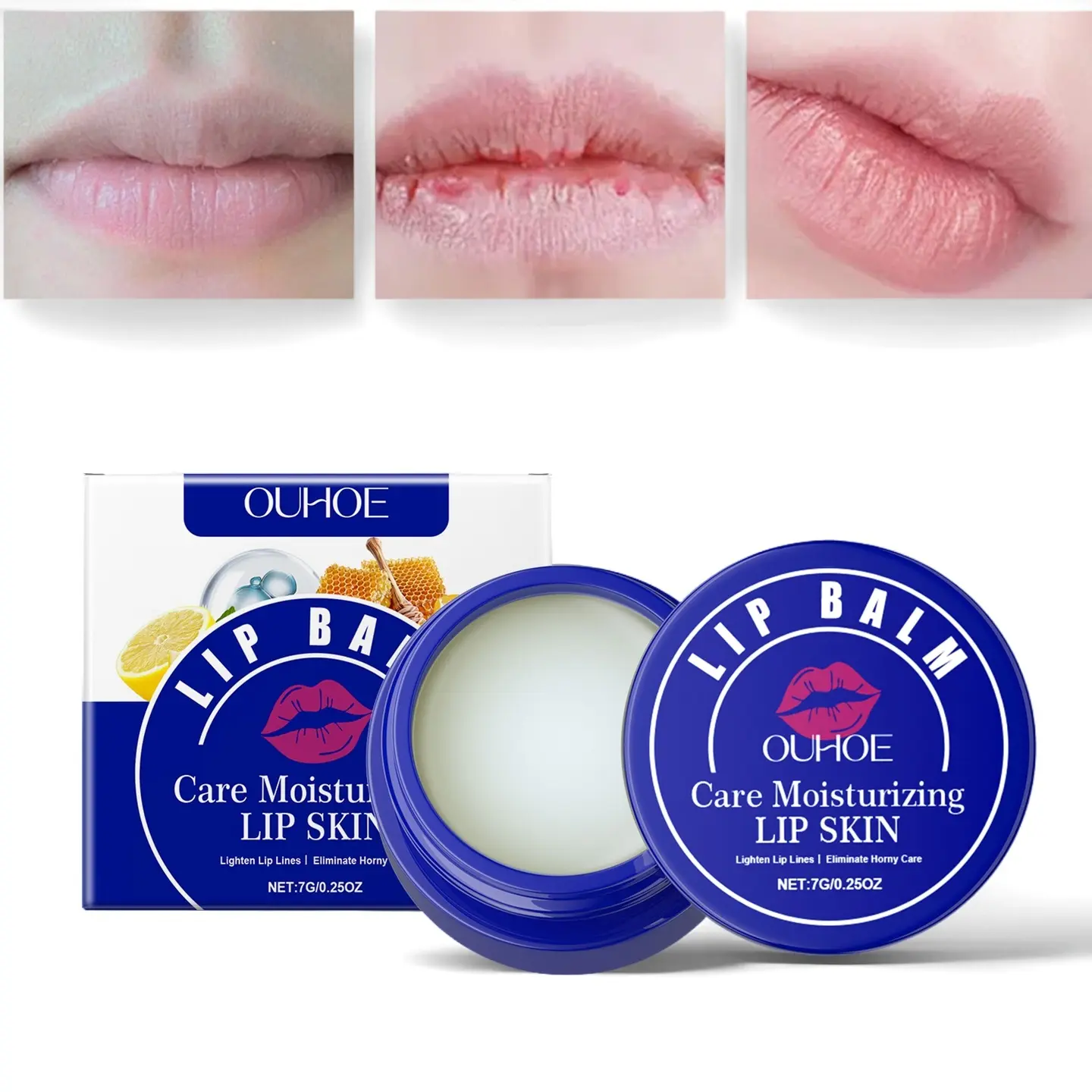 TrueRelief Anti-Acne Natural Lip Cream - Hydrating Moisturizer with Lemon (Citrus), Papaya & Beeswax, Smooth Lip Color Corrector Balm for Adults to Even Tone & Reduce Fine Lines, Lock in Moisture