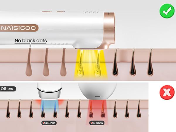 Laser Hair Removal Ice Cooling, Painless IPL Laser Hair Removal Device At-Home Permanent ipl device Portable IPL Smooth Comfort IPL Hair hair remival