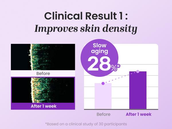 PDRN Active Boost Face Serum - Salmon DNA Serum for Face, Smoothing Fine Lines & Wrinkle, Rejuvenating & Firming Skin, Anti-aging Booster with Collagen, Korean Skin Care, 1.01 fl. oz. (30ml)