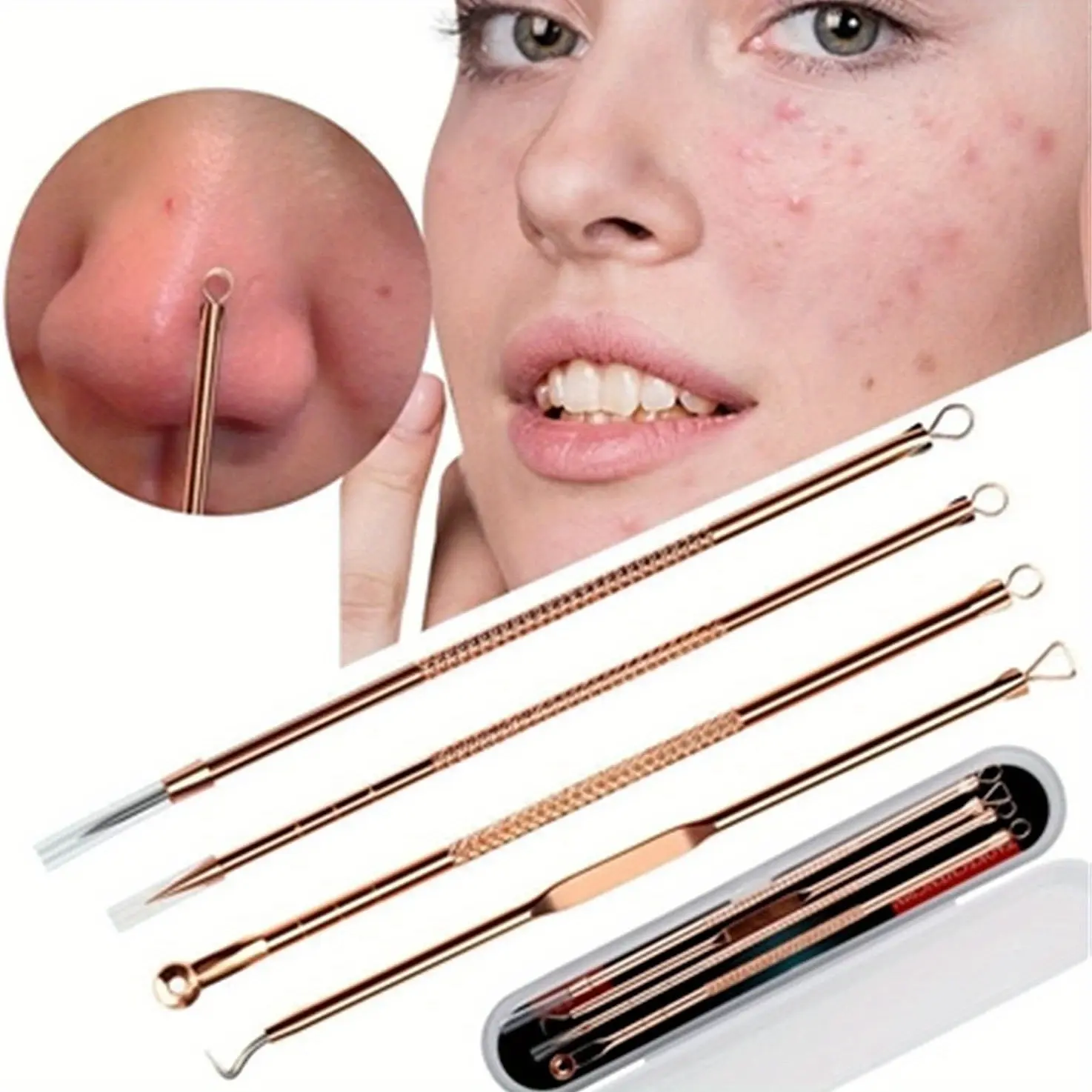 4 Pcs/set Rose Golden Blackhead Remover Tools Set, Professional Stainless Steel Acne & Pimple Extraction Tweezers, Precision Skincare Kit With Case For Facial Care