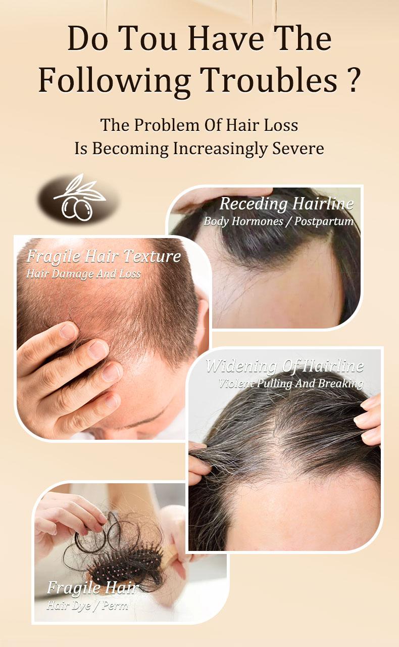 Gypsophila Batana Oil&Rosemary Oil - Hair Growth, Nourish Scalp & Detox for Strong & Healthy Hair - 30 mL Haircare with Organic Batana nourish hair natural oil Gypsophila Batana Oil&Rosemary Oil - Hair Growth, Nourish Scalp & Detox for Strong & Healthy Hair - 30 mL Haircare with Organic Batana nourish hair natural oil