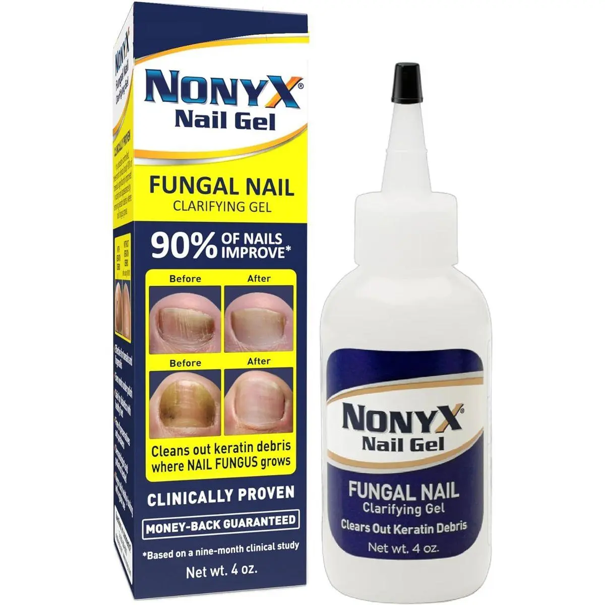 Fungal Nail Clarifying Gel | Clinically Proven for Discolored, Thick, Brittle, Yellow, Lifted, and other signs of Fungus-Damaged Toenails | 90% of Nails Improve | Over 8 million sold