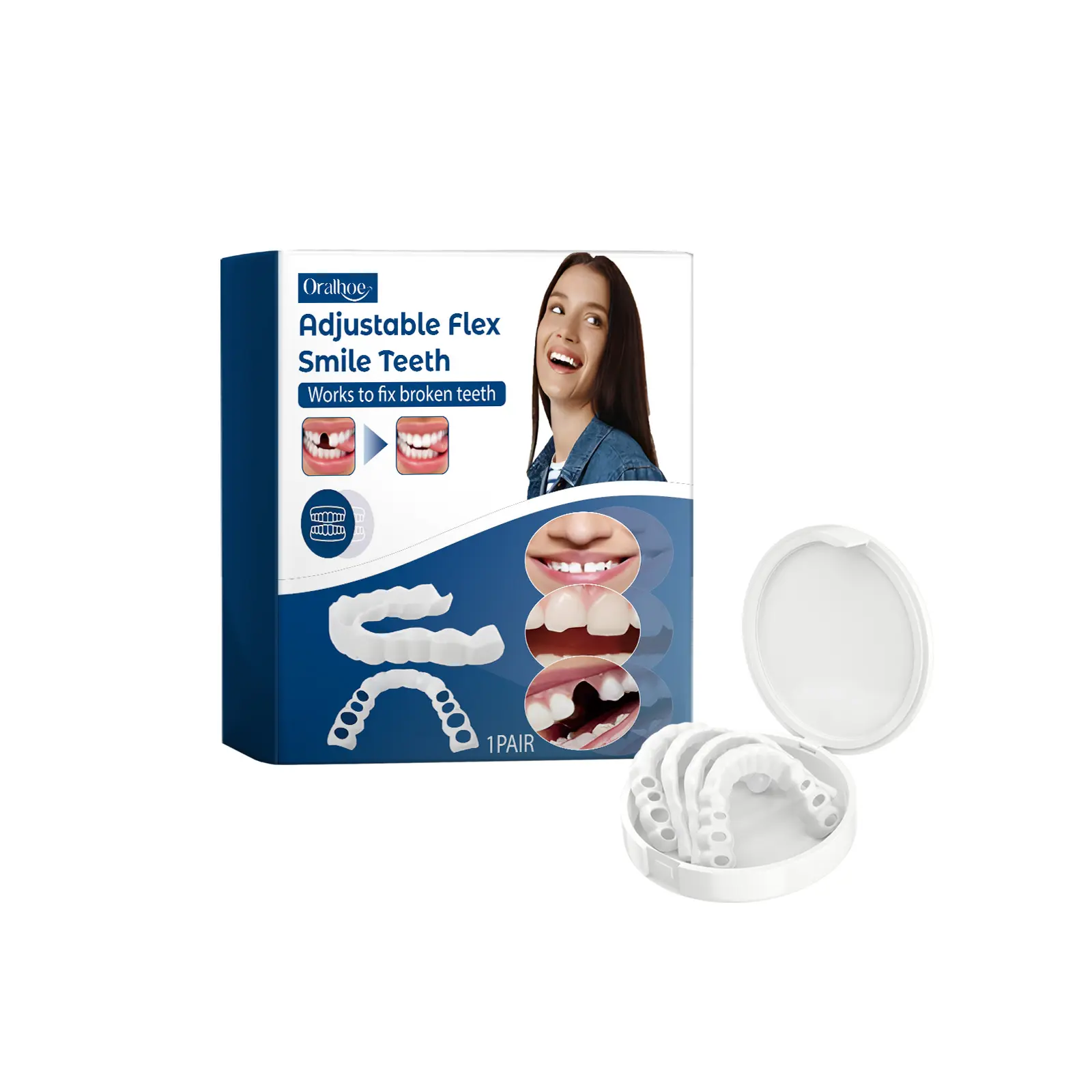 Oralhoe Adjustable Snap‑on Veneers, Realistic Simulation Fake Teeth, Temporary Cosmetic Denture Kit for Instant Smile