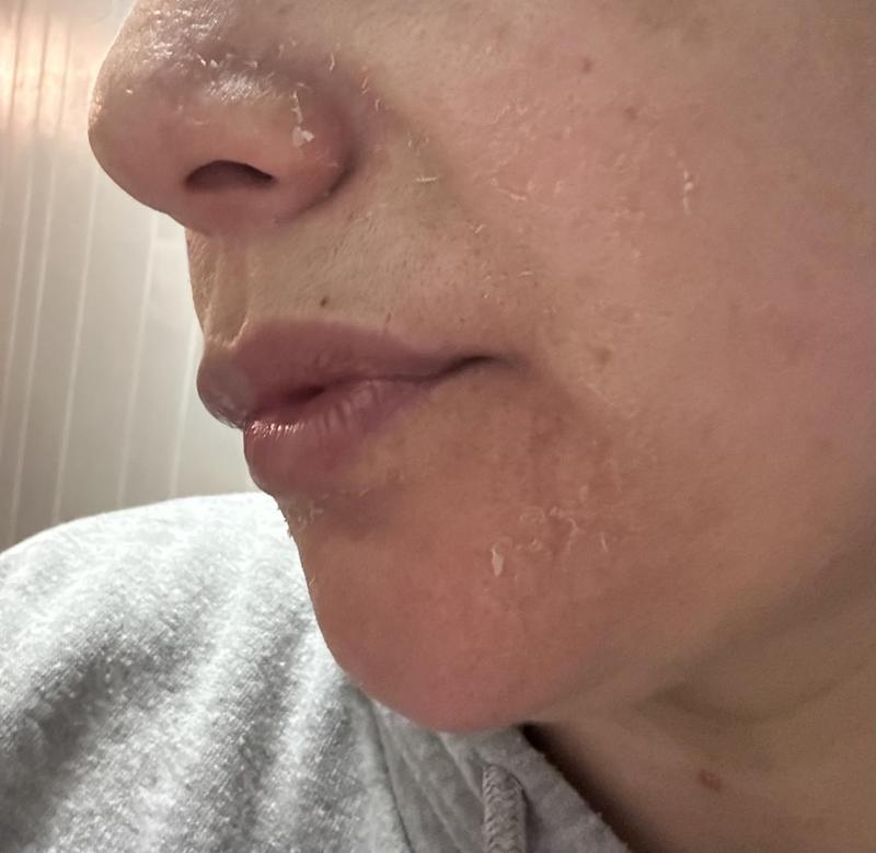 Retinol Gel 0.1 Vitamin A Repairs Fine Lines & Wrinkles, Scar Treatment, Age and Sun Spots, Anti-Aging Formula Gel 20 Grams Firming Rejuvenating Skin Firming Deep Hydration