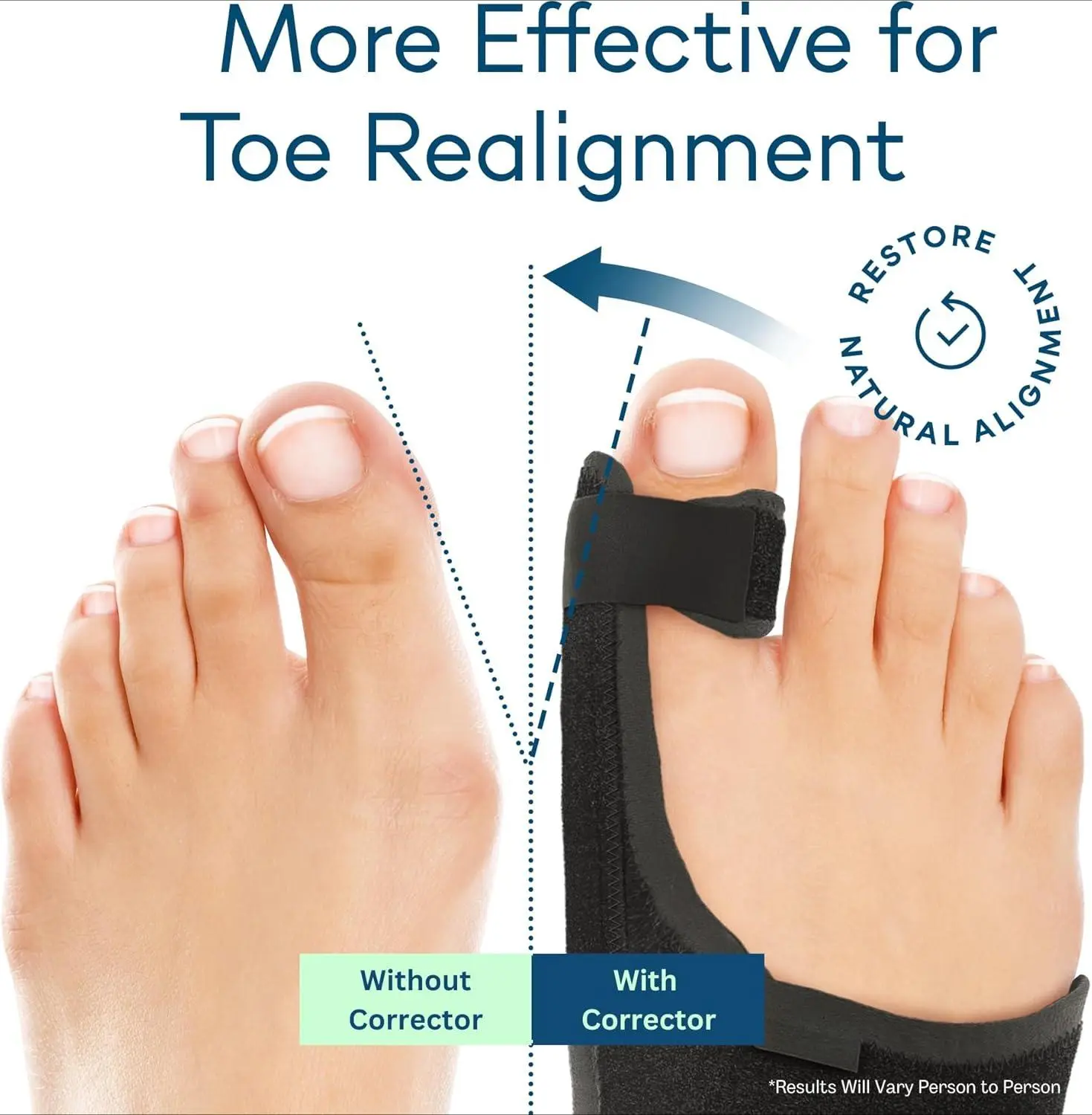 Soft Fabric Toe Separator with Adjustable Support Strap - 2 Pcs, 0.35oz Nail Care Toe Alignment Manicure Accessories for Daily Wear, Day Night Use