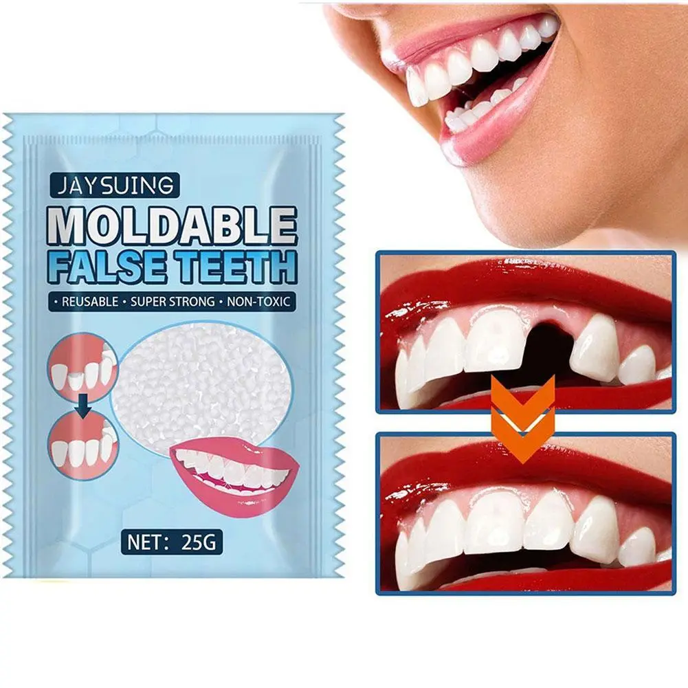 Resin 25g Temporary Tooth Repair Kit Teeth And Gaps False Teeth Solid Glue Denture Adhesive Teeth Whitening Tooth Beauty