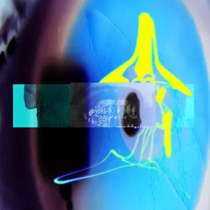 E L U C I D - I Guess U Had to Be There  [VINYL RECORD - LP] Explicit, Colored Vinyl, Clear Vinyl