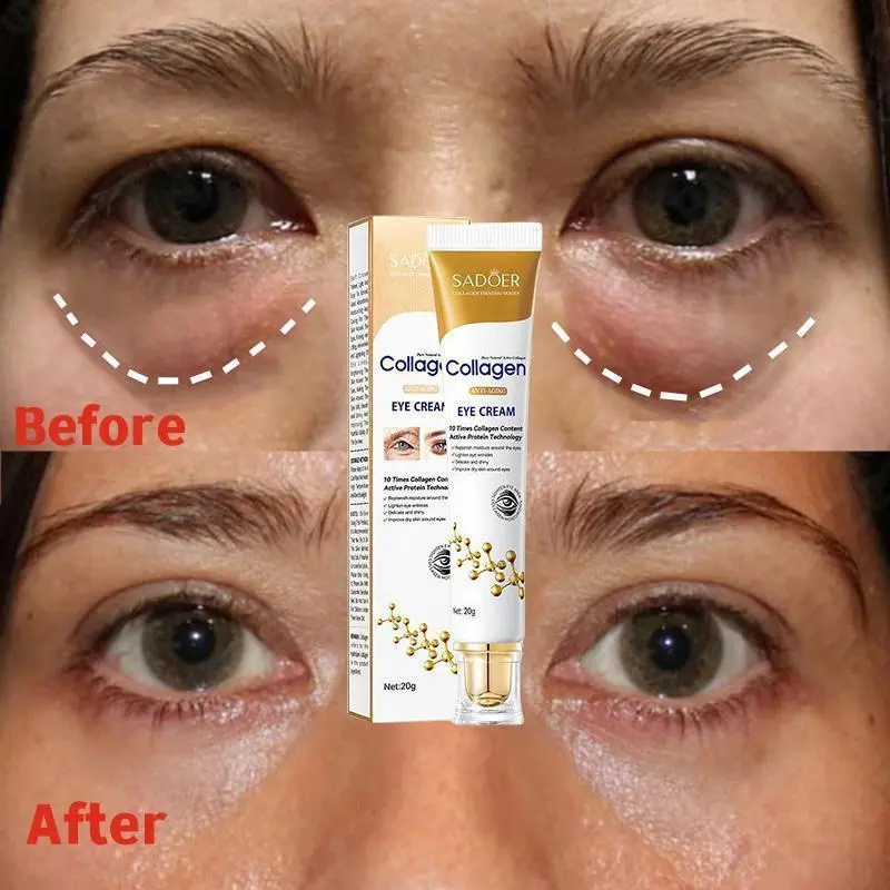 Instant Eye Bag Removal Cream Removal Wrinkles Firming Skin Collagen Fade Fine Lines Brighten Dark Circle Anti Puffiness