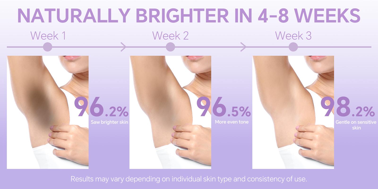 Bikini & Underarm Dark Spot Care Serum for Sensitive Skin – Brightening Formula with Niacinamide & Vitamin C, Helps Even Skin Tone & Smooth Skin for Intimate Areas (Women & Men)