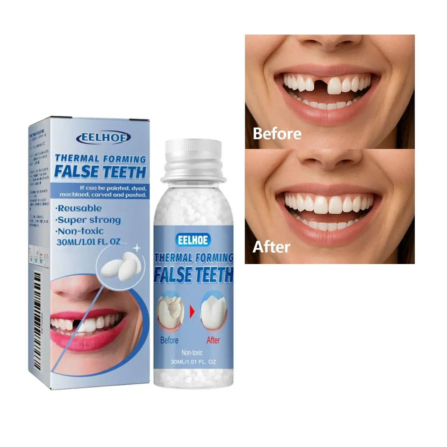 EELHOE Moldable Denture Pellets for Cavities，Moldable dental gel ...