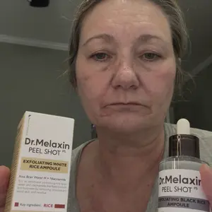 Product Review of [Dr.Melaxin Official] Peel Shot Glow Rice Ampoule Duo - Serums for Brightening, Exfoliating, and Moisturizing - Suitable for All Skin Types from R**❌
