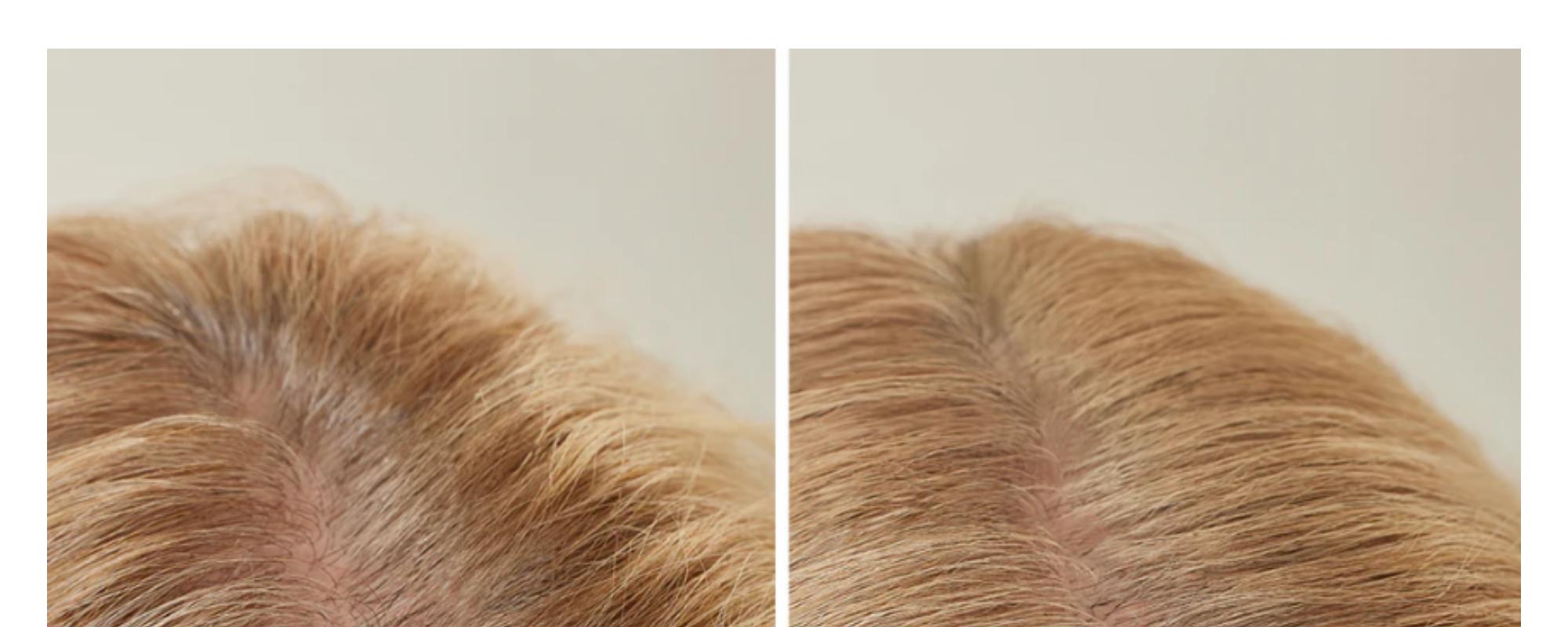 Build & Conceal Bundle: Hairline Powder & Hair Fibers