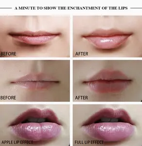 Automatic Silicone Lip Plumper Device  Fuller-looking lips. No needles. No chemicals. Just results.