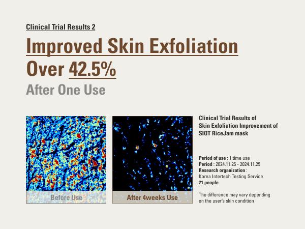 SIOT Rice Jam Mask 8.45oz | Korean Rice Brightening & Hydrating Wash-Off Face & Body Mask | Gentle Exfoliating, Glow & Smooth Skin Care Lightweight Moisturizing Radiant Sensitive Skin SIOT Rice Jam Mask 8.45oz | Korean Rice Brightening & Hydrating Wash-Off Face & Body Mask | Gentle Exfoliating, Glow & Smooth Skin Care Lightweight Moisturizing Radiant Sensitive Skin