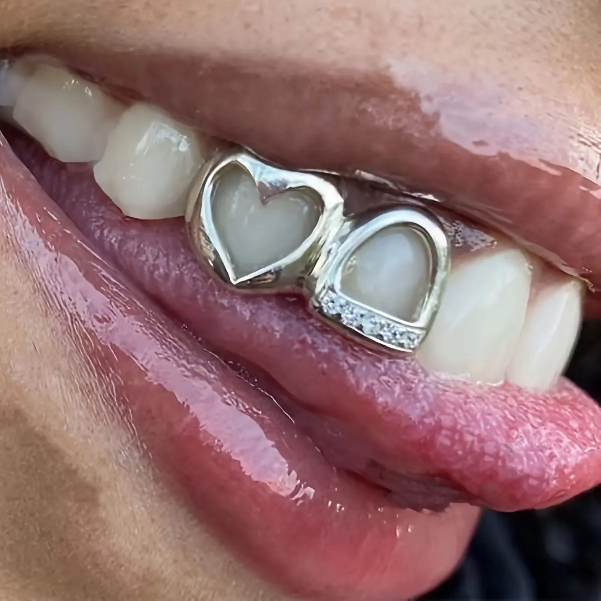 Hollow Heart-shaped Inlaid Teeth Love Women's Teeth Inlays Double Sets Of Wire Frames Men And Women Shiny Teeth Decoration Casual Clothing Body Decoration