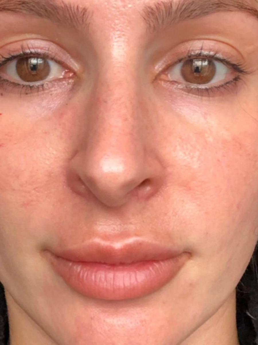 Item: 【6 Vials】50% off /15-day supply /Skin Firming